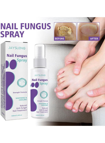 100ml Nail Fungus Spray Soothing and Cooling Treatment Spray with Free Shipping