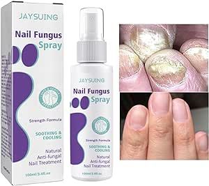 100ml Nail Fungus Spray Soothing and Cooling Treatment Spray with Free Shipping