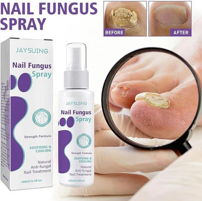 100ml Nail Fungus Spray Soothing and Cooling Treatment Spray with Free Shipping