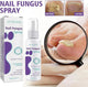 100ml Nail Fungus Spray Soothing and Cooling Treatment Spray with Free Shipping